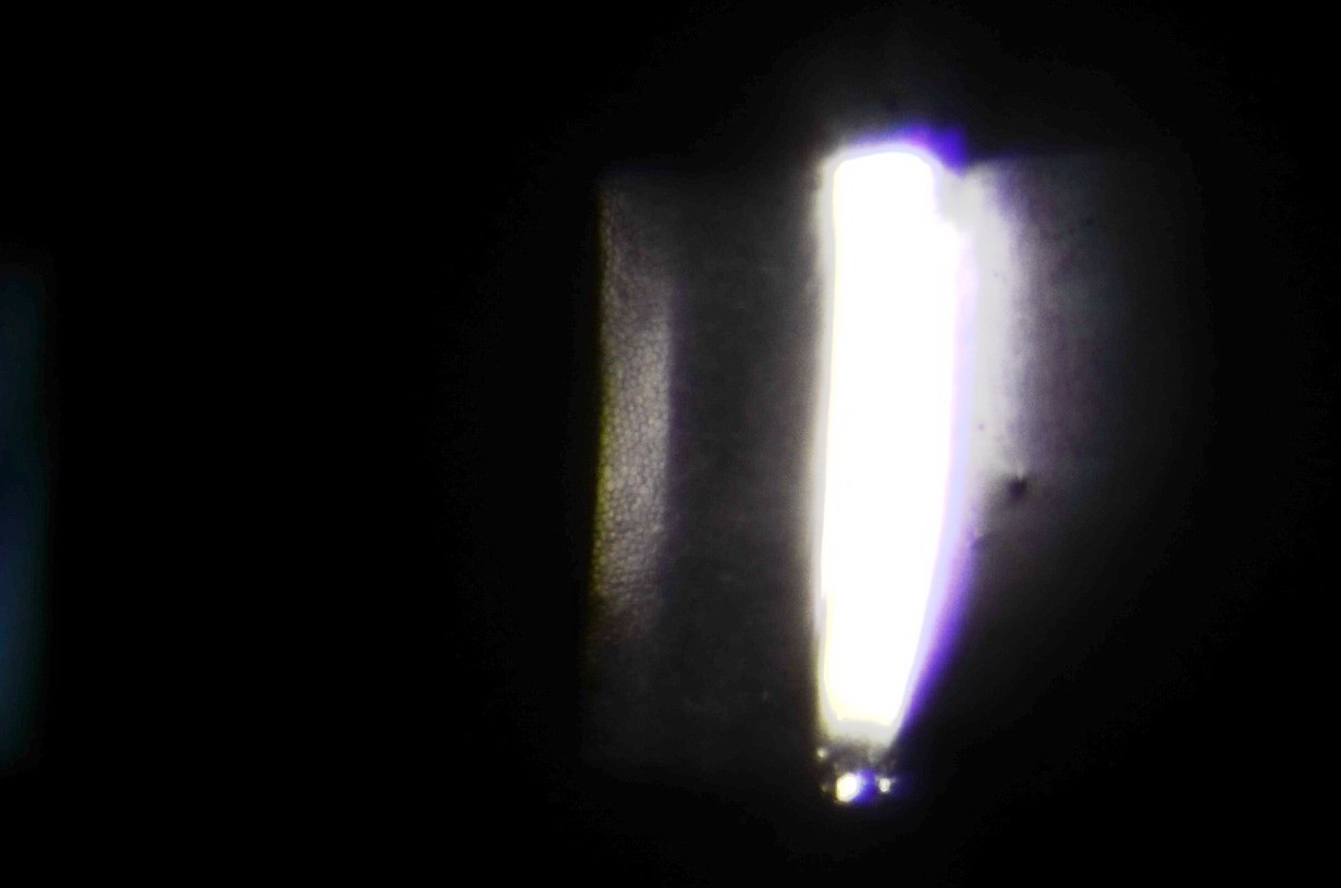 Corneal epithelial cells.jpg